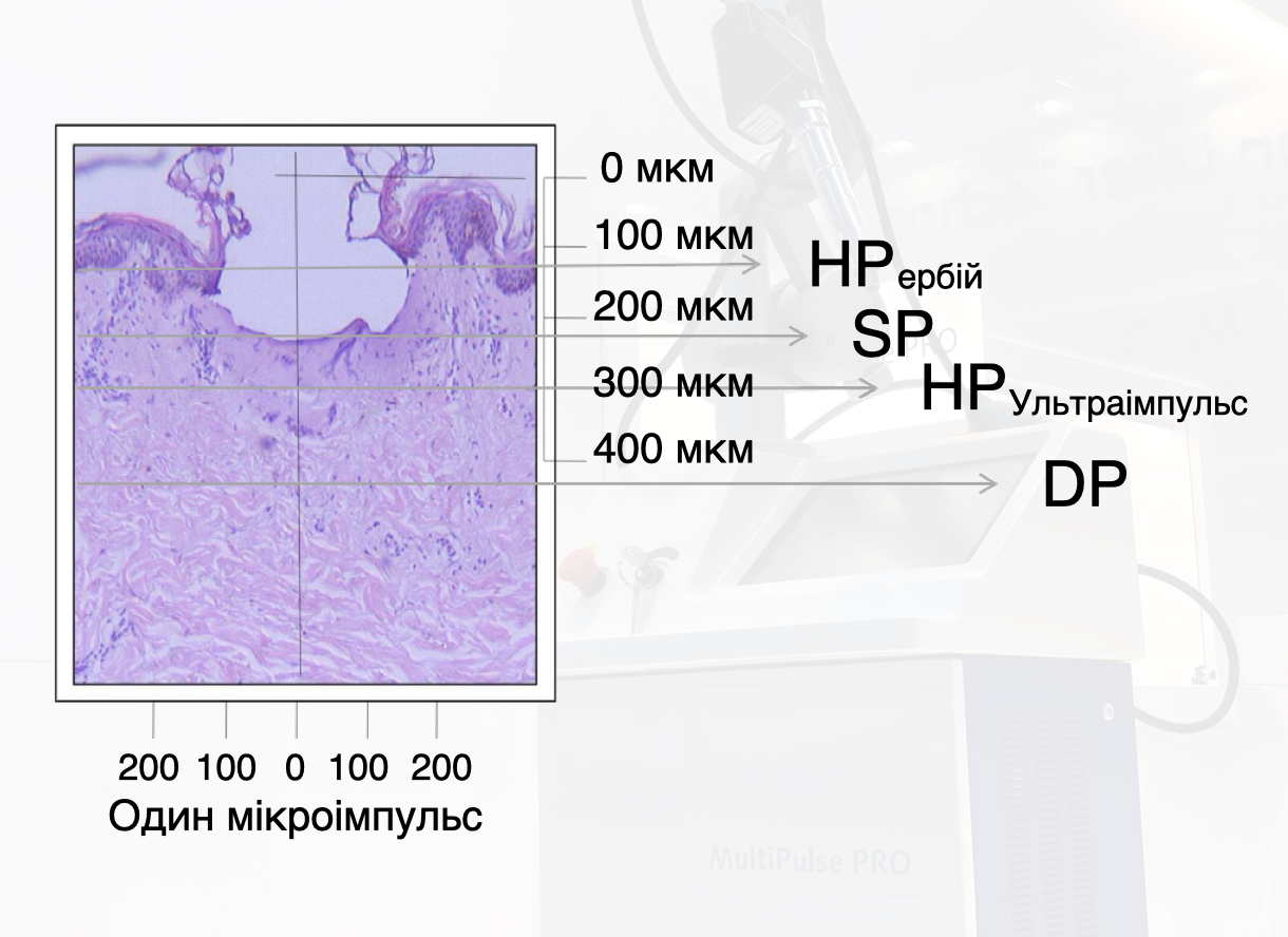 Asclepion MultiPulse PRO ➜ Професійний лазер CO2 в Україні | Alfaspa зображення 53